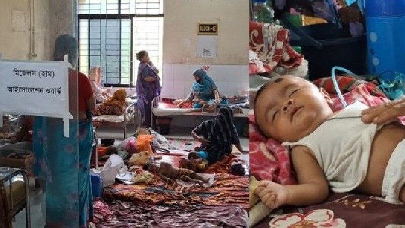 চাঁদপুরে হামের প্রকোপ বেড়েছে, হাসপাতালে ভর্তি ২৮ শিশু; মৃত্যু ৩