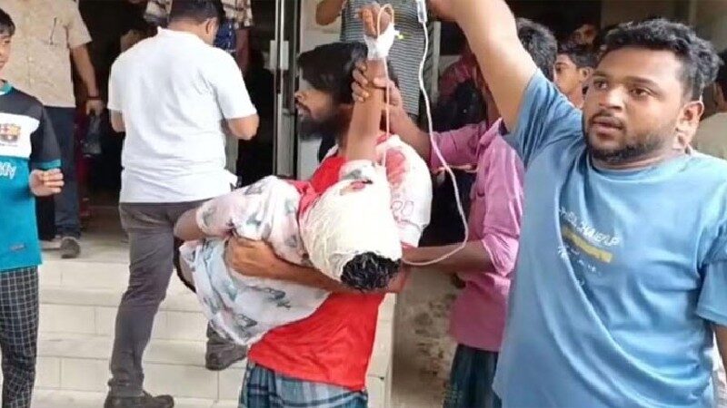 ফরিদগঞ্জে সিএনজি-মোটরসাইকেল সংঘর্ষে দুই কিশোর আহত, একজনের অবস্থা আশঙ্কাজনক